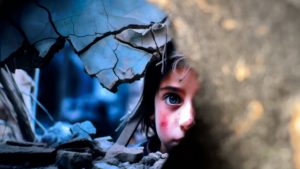 مأساة رزان.. طفلة غزية تحلم بساق صناعية