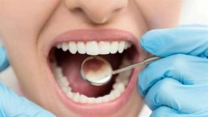 حكم بيع الأسنان المخلوعة للأطباء والطلاب.. دار الإفتاء تجيب