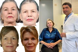 يحصل سكان نيويورك على الوجهين الثاني والثالث بحثًا عن الشباب الأبدي: “متوسط العمر المتوقع يرتفع … لا أعرف ما إذا كان بإمكاننا القول أربعة الكثير”