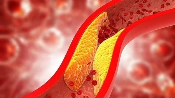 مشروبات تساهم في خفض الكوليسترول بشكل طبيعي.