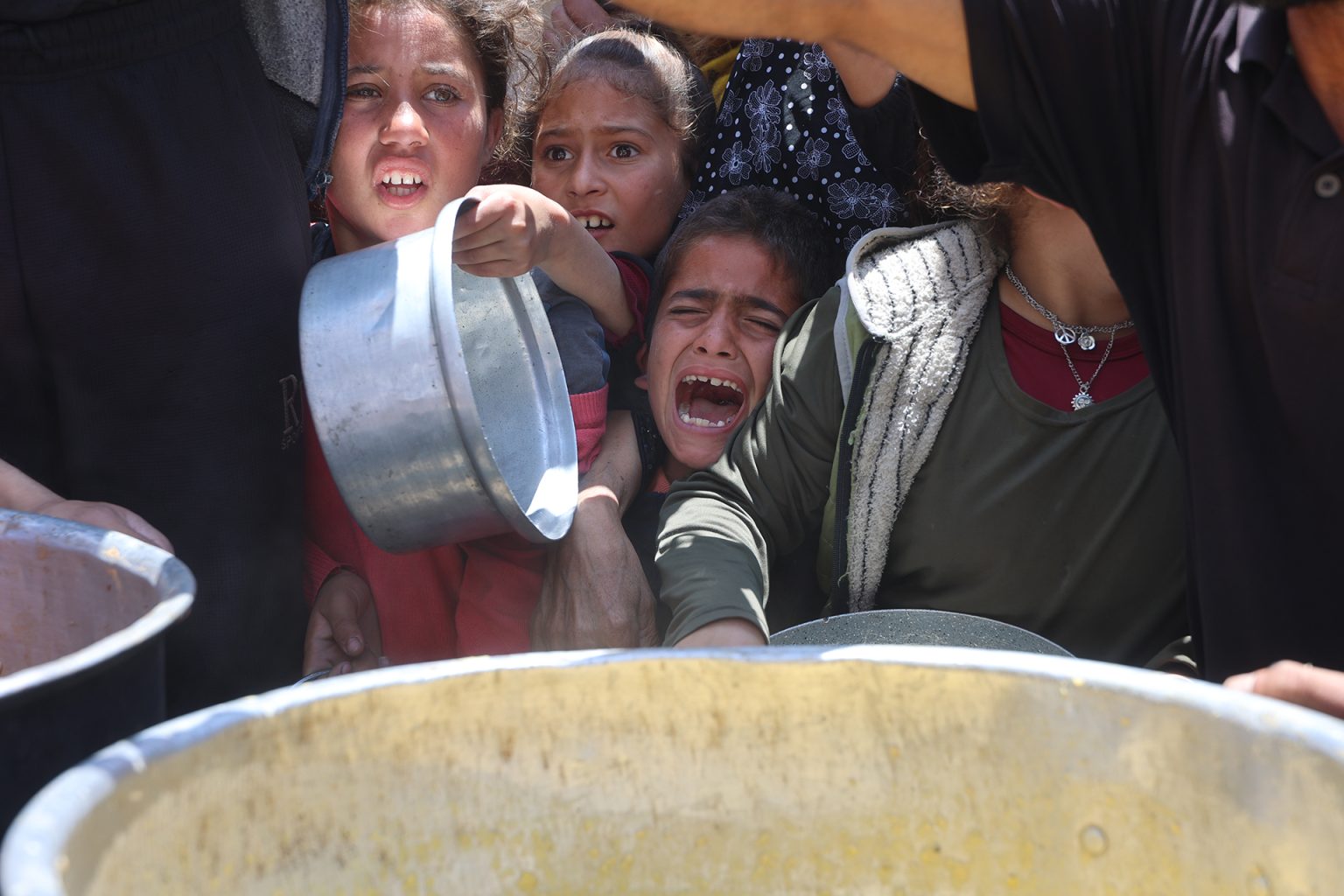 إصابات بالتهاب السحايا في غزة وحماس تحذر من كارثة تتهدد أطفال القطاع