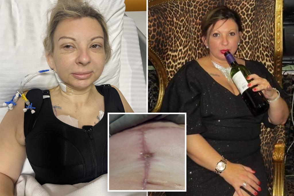 لقد أنفقت أكثر من 9 آلاف دولار على “تحول الأم” في تركيا – إنها “ندم على حياتي” في حياتي