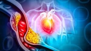 طعام واحد يساعد على خفض الكوليسترول .. تناوله بإستمرار