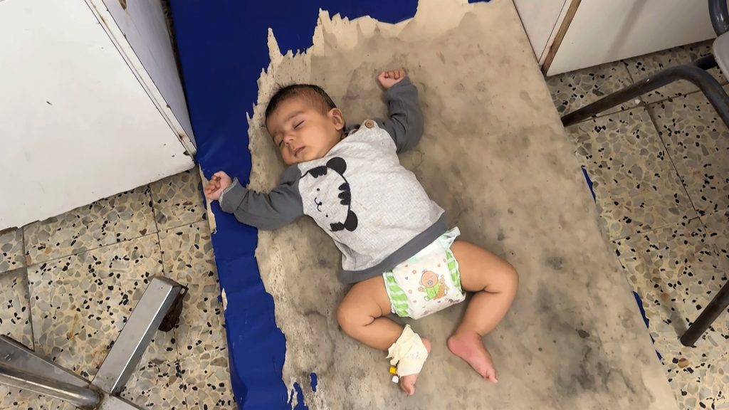 كارثة صحية جديدة في غزة.. 35 حالة حمى شوكية في مجمع ناصر