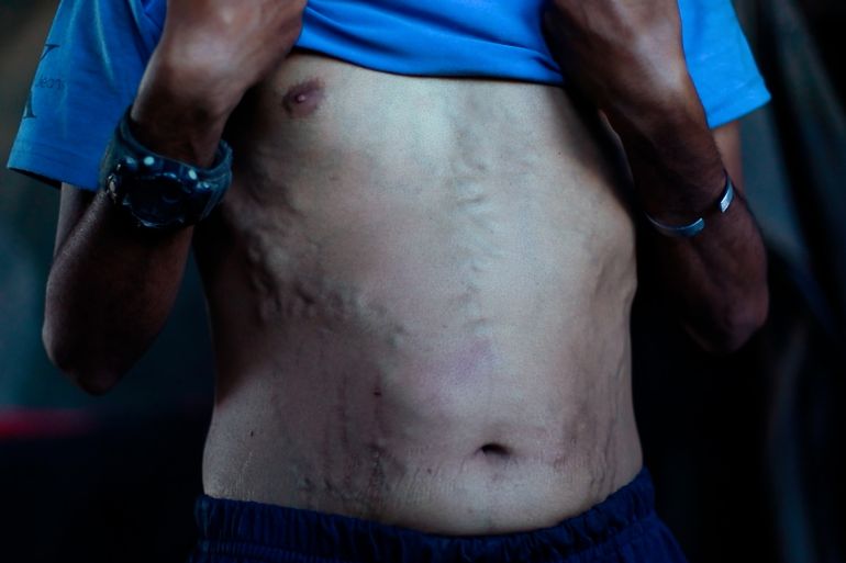 قصص إنسانية.. أم محمد أبو عوده