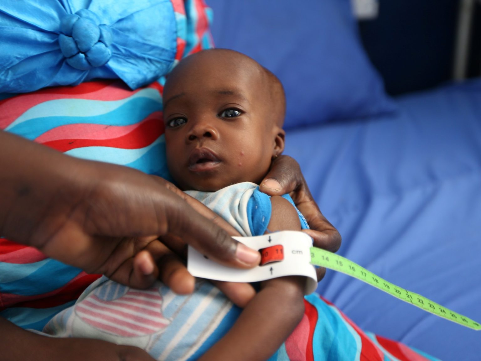 قتل سوء التغذية في نيجيريا 652 طفلاً في الأشهر الستة الماضية ، كما يقول منظمة أطباء بلا حدود