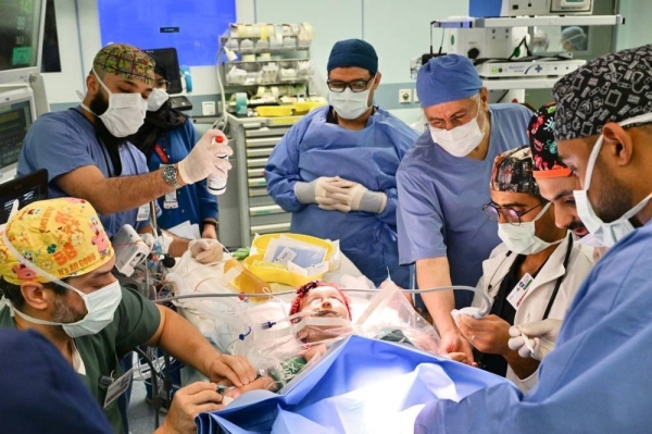 السعودي ملتصق التوأم يارا ولارا لعملية انفصال في الرياض في رياده