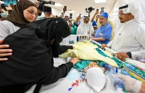 سعودي ملتصق التوأم يارا ولارا بنجاح في جراحة 12.5 ساعة
