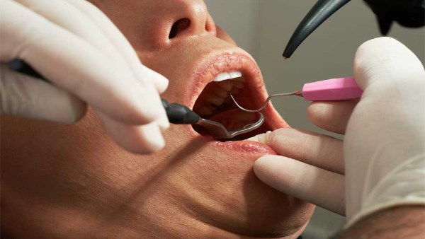 هل فينير الأسنان يؤثر على صحة الغُسل أو الوضوء؟.. دار الإفتاء تجيب