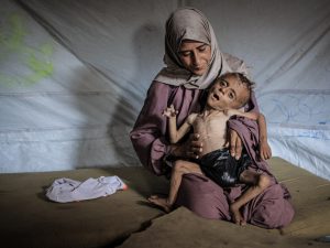 بالصور.. الجوع يفتك بأطفال غزة والعالم يتفرّج