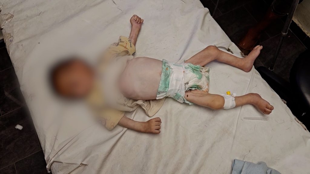 أمنستي: تجويع غزة سياسة إسرائيلية ممنهجة وجريمة حرب تتطلب تحركا دوليا عاجلا