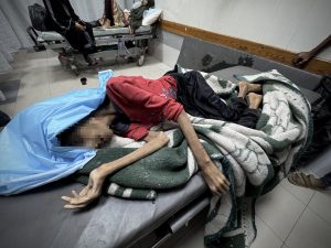 ورحلت رحيل وهي تزن 25 كيلوجراما فقط