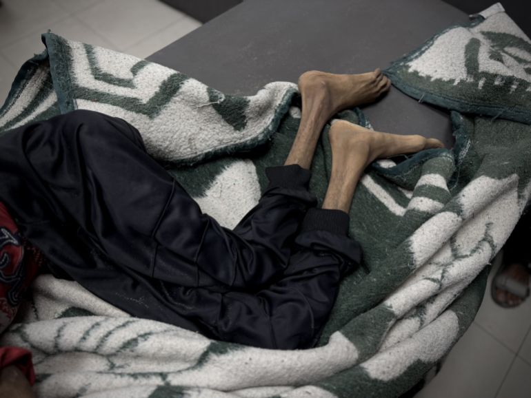 İsrail saldırıları altındaki Gazze Şeridi'nde açlık ve yetersiz beslenme can almaya devam ediyor. Han Yunus'taki Nasır Hastanesi'nde tedavi gören ve 25 kiloya düşen Rahil Muhammed Rasras (32) isimli kadın, yaşamını yitirdi. ( Abdallah F.s. Alattar - Anadolu Ajansı )