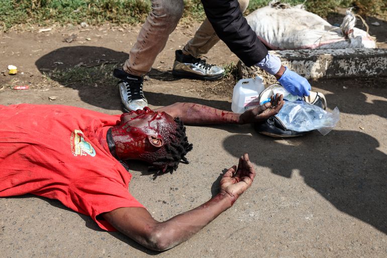 epa12222550 An injured protester seeks medical help from a volunteer firstaider after being shot with a rubber bullet by anti-riot police during anti-government protest on Saba Saba day (or Seven-Seven in Swahili language) in Nairobi, Kenya, 07 July 2025. Nairobi’s Central Business District remained on a lockdown as most business owners hired counter-protesters armed with clubs to protect their business from looters as police used tear gas and rubber bullets to disperse hundreds of protestors in the outskirts of Nairobi during the protest. The Saba Saba Day commemorates protests and government crackdown on a multi-party democracy movement in Kenya in the 1990s. EPA/DANIEL IRUNGU