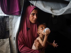 صورة طفل فلسطيني بوجه غائر وذراع هزيلة تشعل حملة تضليل رقمية عالمية