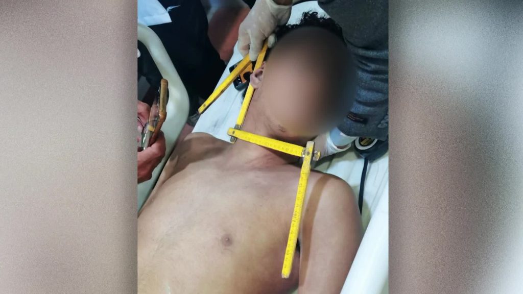 وفاة فتى يمني تحت قدمي “مشعوذ” تشعل غضبا واسعا | أخبار