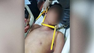 وفاة فتى يمني تحت قدمي “مشعوذ” تشعل غضبا واسعا | أخبار