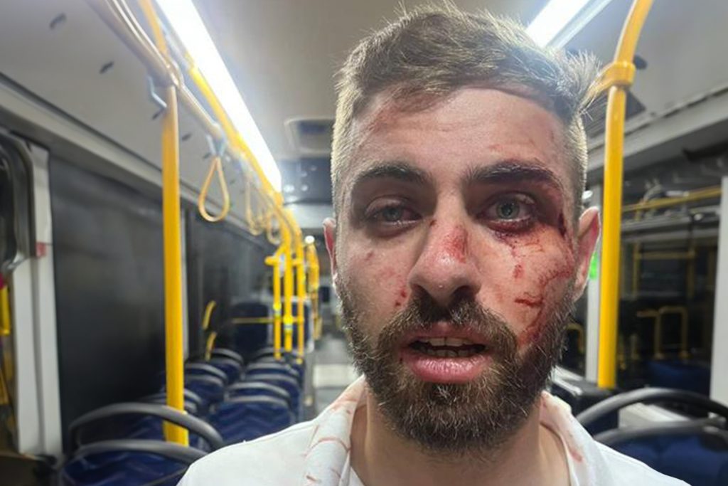 القدس.. مستوطنون يعتدون على سائق فلسطيني واتهام للشرطة بالتقاعس الأمني