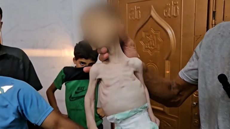 وفاة اطفال بغزة نتيجة عدم توفر الحليب والطعام