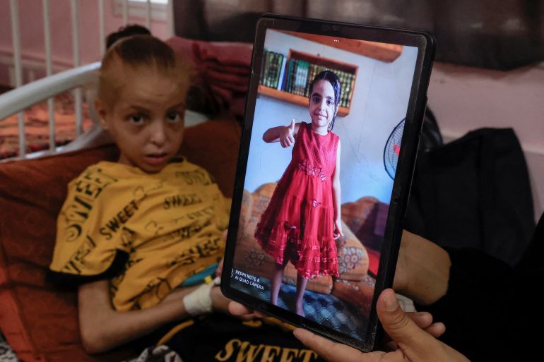 Palestinian girl Huda Abu Al-Naja lies on a bed receiving treatment at the malnutrition ward at Nasser hospital as her mother Sumayya shows an image of Huda when she was healthier, in Khan Younis, southern Gaza Strip, August 5, 2025. REUTERS/Hatem Khaled