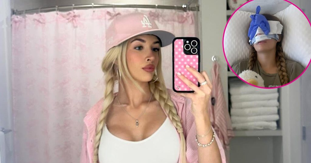 تنعكس سامي شين على عملية تجميل الأنف بعد عام واحد من الذهاب تحت السكين: “أفضل قرار”