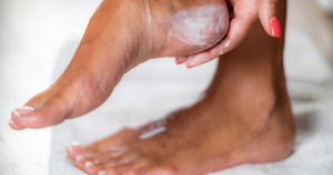 أقدام جافة ، متشققة؟ حتى الممرضات يوافقون على هذا الكريم المرطب البالغ 16 دولارًا والذي يتقن عيوب