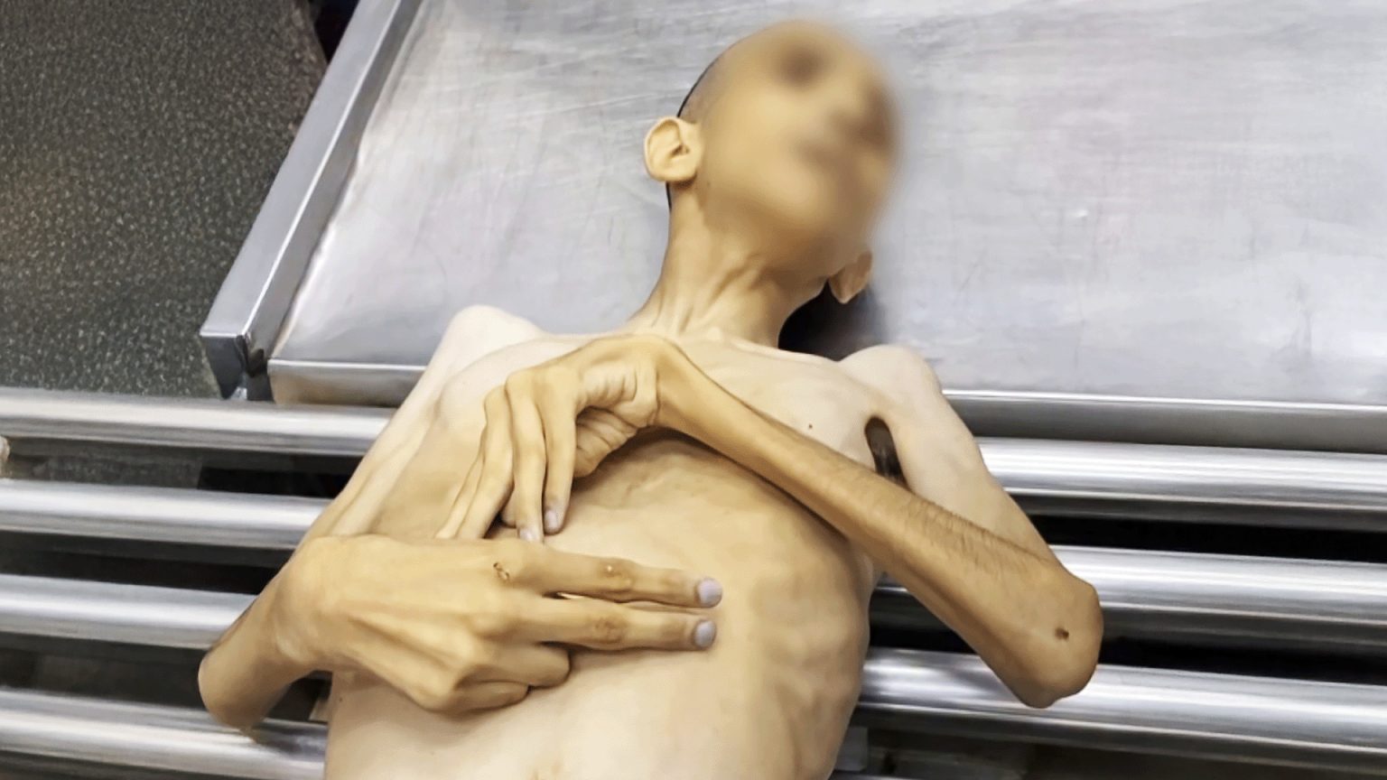 “شعب بأكمله يُقتل”.. نشطاء يصفون المجاعة في غزة | أخبار