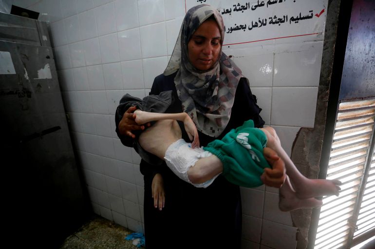 توفي الطفل الفلسطيني تامر شحيبر، الثلاثاء، في "مستشفى شهداء الأقصى" وسط قطاع غزة، متأثرا بمضاعفات سوء التغذية الحاد، نتيجة الحصار والتجويع الإسرائيلي المستمر على القطاع منذ أشهر. وقال مصدر طبي للأناضول إن الطفل تامر (15 عاما) نقل إلى المستشفى في حالة حرجة، حيث بدا جسده شديد الهزال، وبدت عظام صدره وظهره بارزة بشكل مؤلم. ( Mohammed Nassar - وكالة الأناضول )