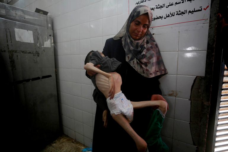 توفي الطفل الفلسطيني تامر شحيبر، الثلاثاء، في "مستشفى شهداء الأقصى" وسط قطاع غزة، متأثرا بمضاعفات سوء التغذية الحاد، نتيجة الحصار والتجويع الإسرائيلي المستمر على القطاع منذ أشهر. وقال مصدر طبي للأناضول إن الطفل تامر (15 عاما) نقل إلى المستشفى في حالة حرجة، حيث بدا جسده شديد الهزال، وبدت عظام صدره وظهره بارزة بشكل مؤلم. ( Mohammed Nassar - وكالة الأناضول )