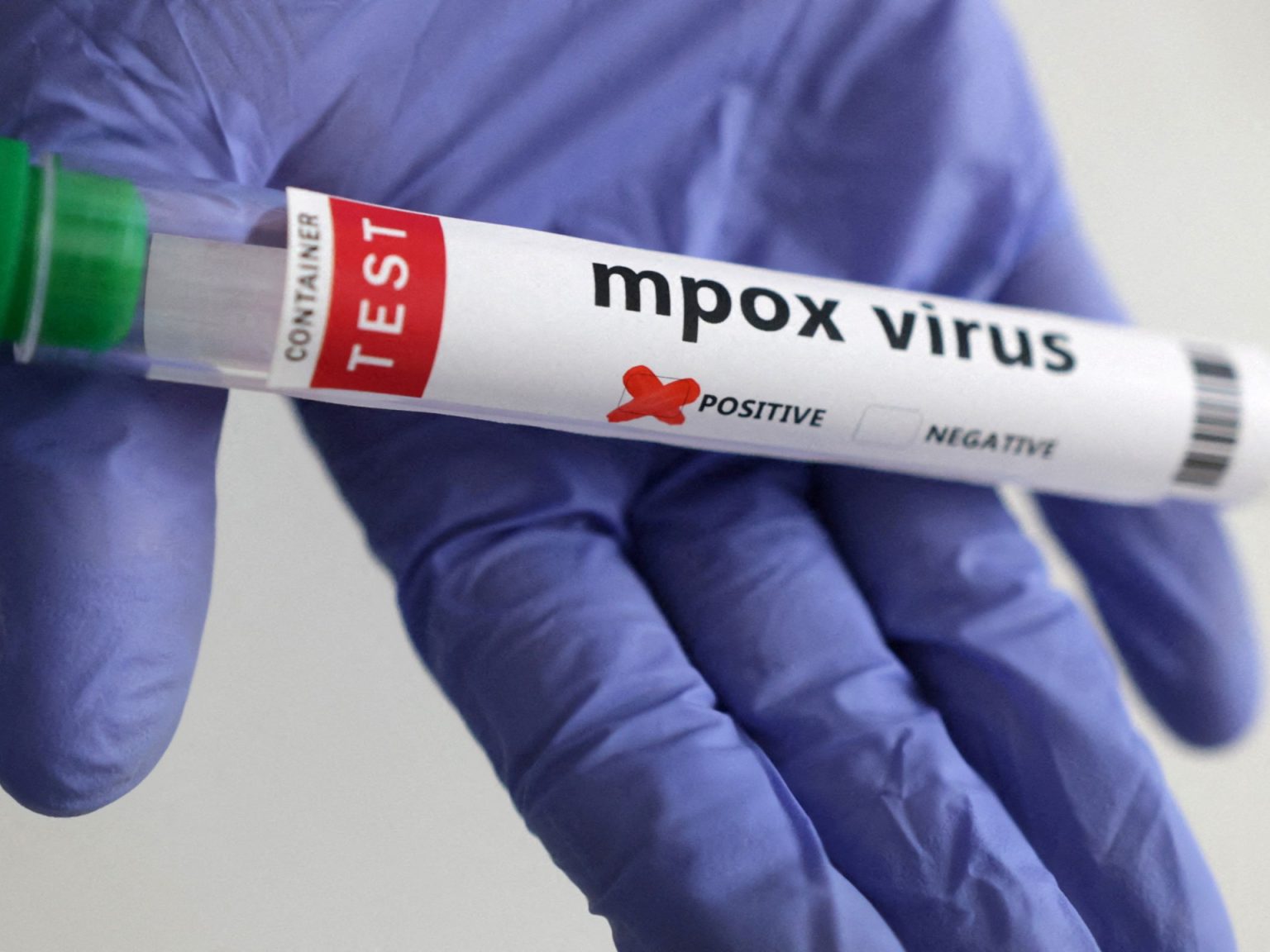 لم يعد MPOX حالة طوارئ صحية دولية ولكن لا يزال القلق في إفريقيا