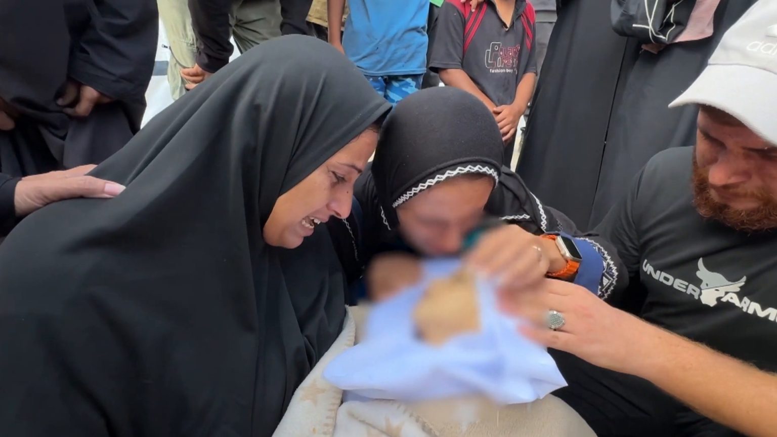 الجوع نهش جسده الصغير.. أيمن طفل ولد في الحرب ومات فيها