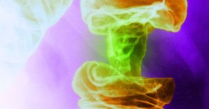 علاج جديد للسرطان يعتمد على الضوء يقتل الخلايا السرطانية ويحافظ على الخلايا السليمة