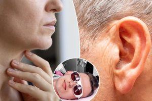 أماكن غريبة يمكن أن ينمو فيها الشعر في الأربعينيات والخمسينيات من العمر وكيفية إزالته