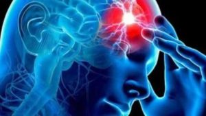 إصابة نجم شهير بجلطة في المخ تثير القلق .. أطباء يوضحون الأسباب والأعراض