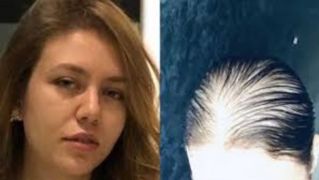 تعرّضت للصلع .. رحمة حسن تكشف تفاصيل حالتها الصحية وتطمئن جمهورها