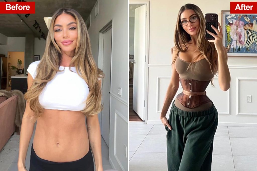 حصريا | تكتسب جراحة إعادة تشكيل الضلع شعبية كبيرة وسط اتجاه “الجسم الأوزيمي” المحفوف بالمخاطر