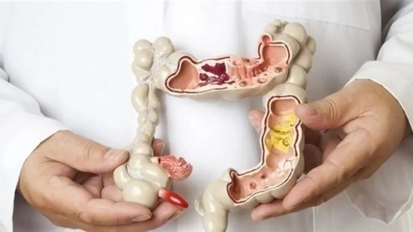 أفضل الشوربات لمرضى القولون والمعدة