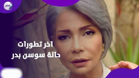 تدخل جراحي عاجل لـ سوسن بدر بعد إصابتها بكسر في القدم