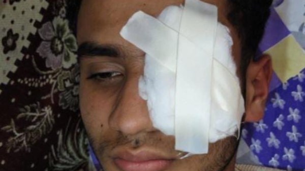 القصاص لفقد عينه ..جنايات طنطا تقضي بالسجن 10 سنوات للكوارشي لتسببه في عاهة مستديمة لشاب بقطور