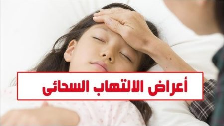 أعراض الالتهاب السحائي.. هل منتشر في مصر؟