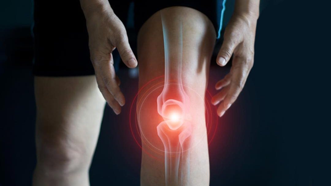 تكلس المفاصل 