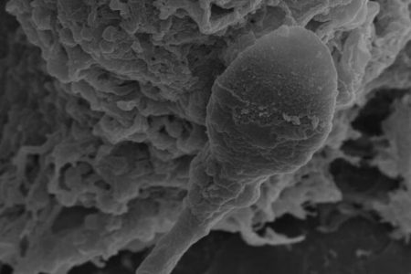 دراسة: الحيوانات المنوية تفقد اتجاهها في الفضاء مع انعدام الجاذبية