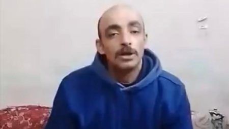 القومي للأشخاص ذوي الإعاقة: استجابة فورية لتوفير الرعاية والخدمة الطبية لفتاة ذات إعاقات متعددة من الغربية