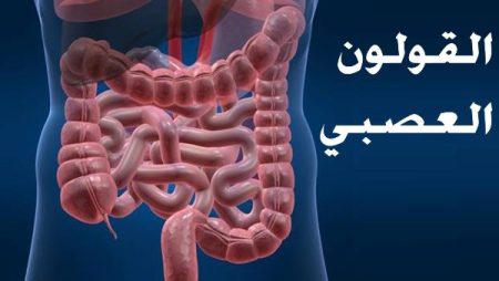 علاج القولون العصبي.. انتبه لهذه الأعراض