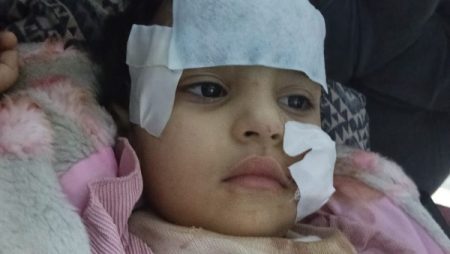 خرابيش و9 غرز.. كواليس إصابة شبل أسد لطفلة بالسيرك القومي وقرارات النيابة