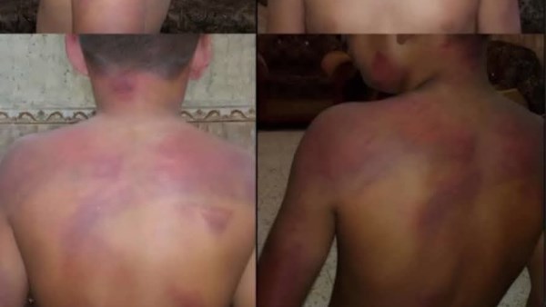 التعذيب بدلًا من الحماية.. اتهامات تهز دار أيتام الكوثر في سوهاج ومطالب بإنقاذ الأطفال