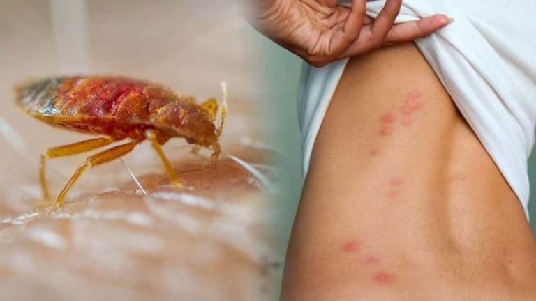 بق الفراش يهاجم غرف النوم.. خبيرة اقتصاد منزلي تكشف الحل الأسرع للقضاء عليه