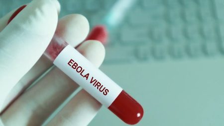أستاذ أوبئة: إيبولا يمر بمرحلتين.. والخطورة تبدأ في الرطبة