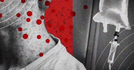 أصبحت الحصبة شائعة جدًا لدرجة أنه قد تكون هناك حاجة إلى علاجات قريبًا