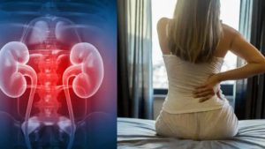 مش هتصدق.. هذه العادات في عطلة نهاية الأسبوع تضر الكلى